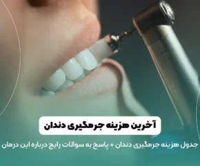 هزینه جرمگیری دندان در سال ۱۴۰۳