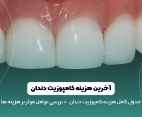 هزینه کامپوزیت دندان در سال 1403