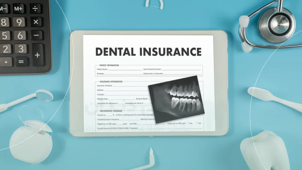 هزینه پر کردن دندان با بیمه دندانپزشکی