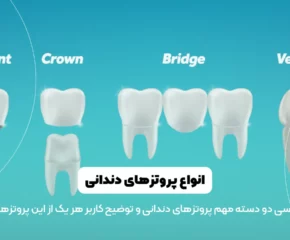 انواع پروتز دندان