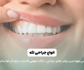 عمل جراحی لثه