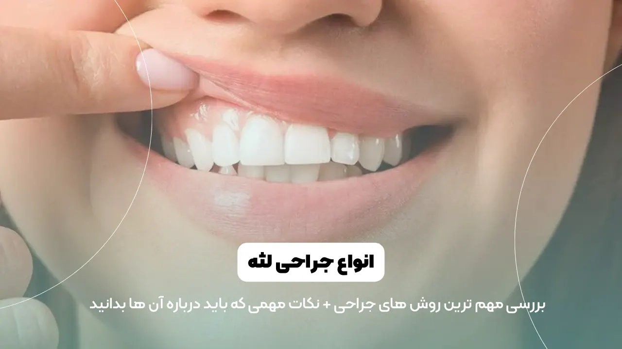 عمل جراحی لثه