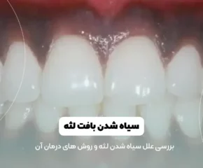 عکس سیاه شدن لثه ها