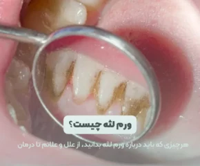 عکس ورم لثه