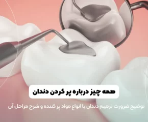 پر کردن دندان ها