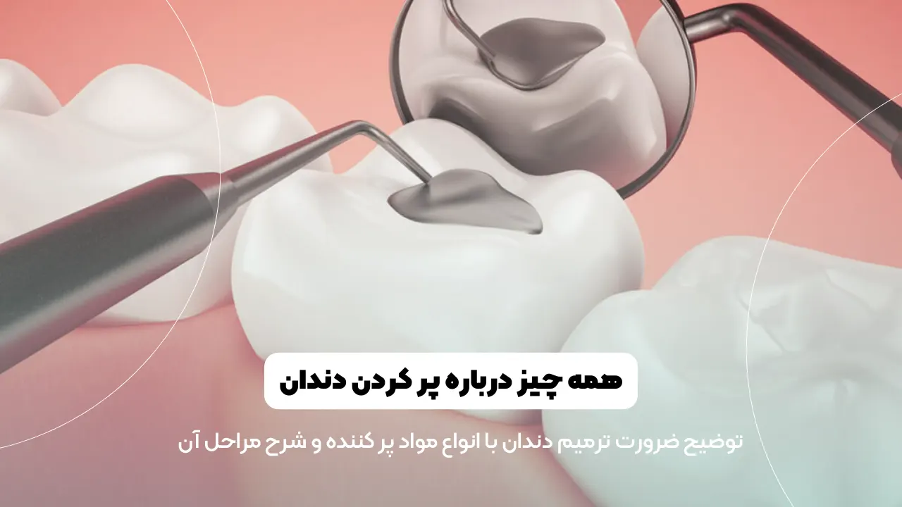 پر کردن دندان ها