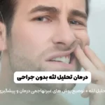 درمان تحلیل لثه بدون جراحی تصویر شاخص