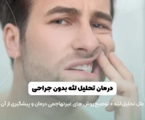 درمان تحلیل لثه بدون جراحی تصویر شاخص