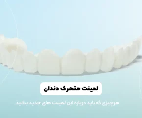 لمینت متحرک دندان شاخص