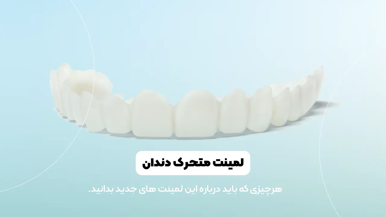 لمینت متحرک دندان شاخص